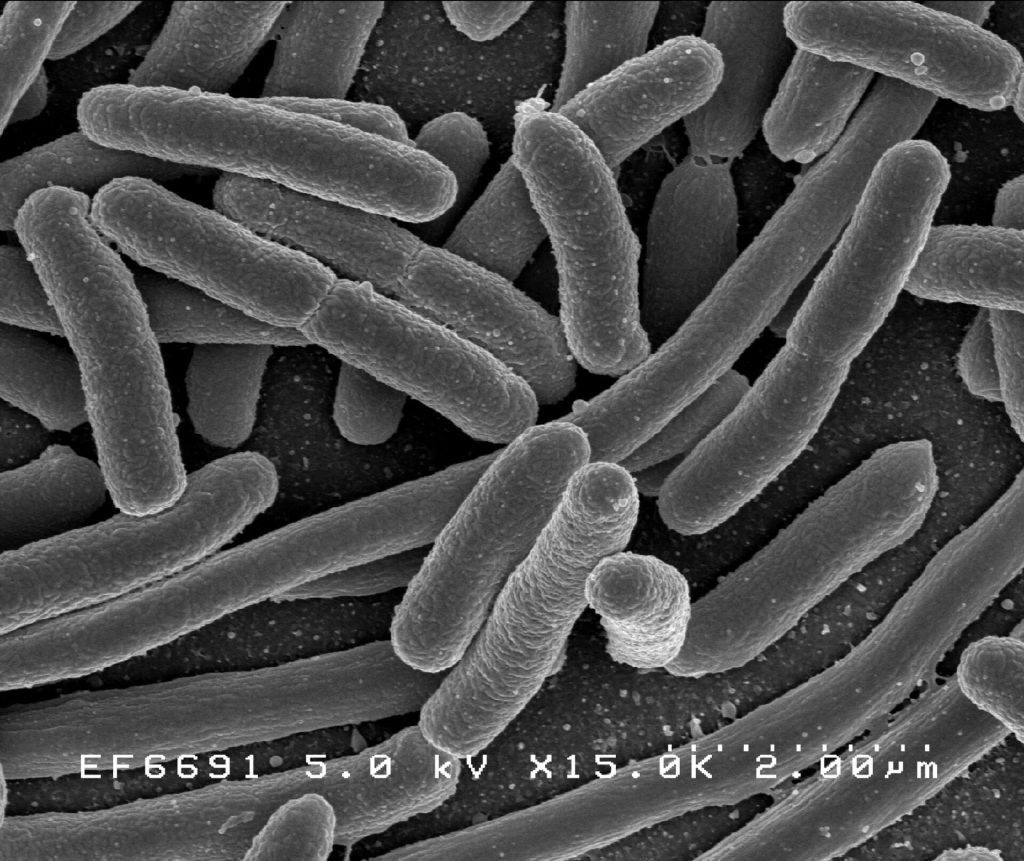Electron micrograph of Escherichia coli bacteria