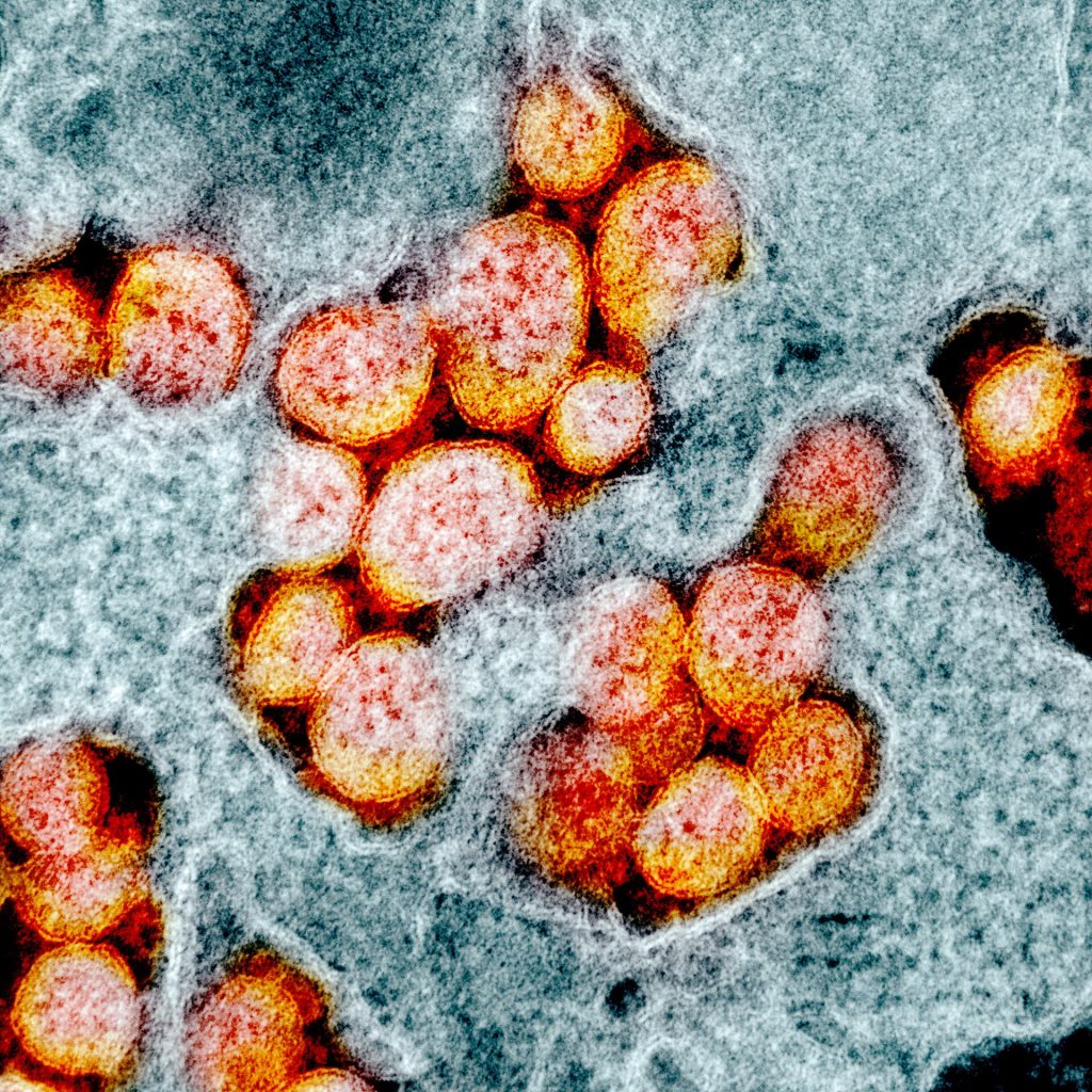 Electron micrograph of SARS-CoV-2 virus particles