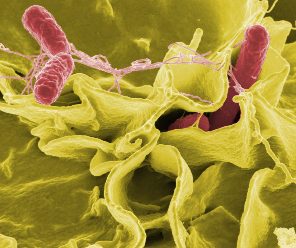 Electron micrograph of Salmonella Typhimurium bacteria